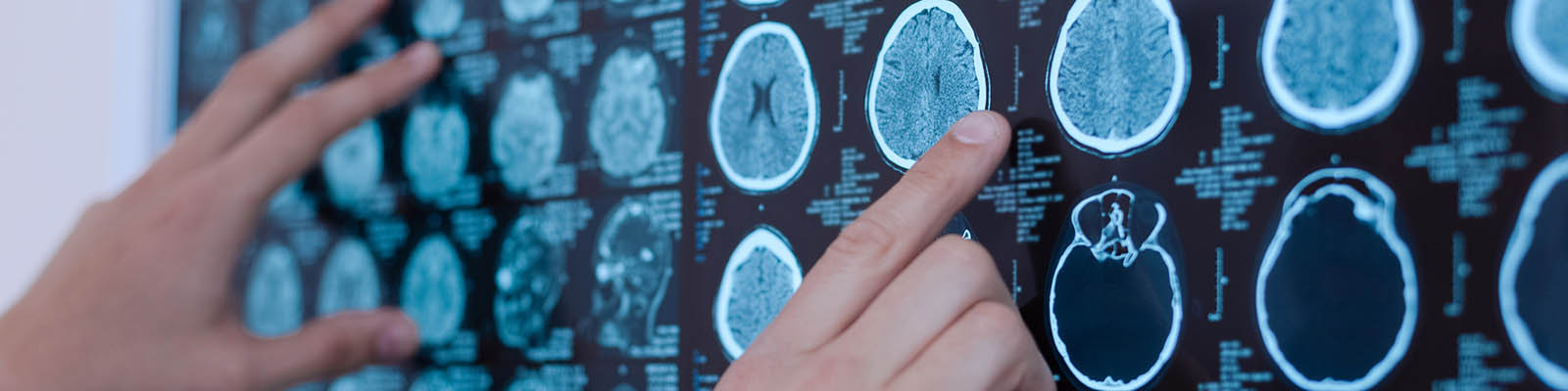 A physician examines a brain x-ray.