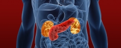 Diagram that shows where the kidneys and pancreas are located in the body