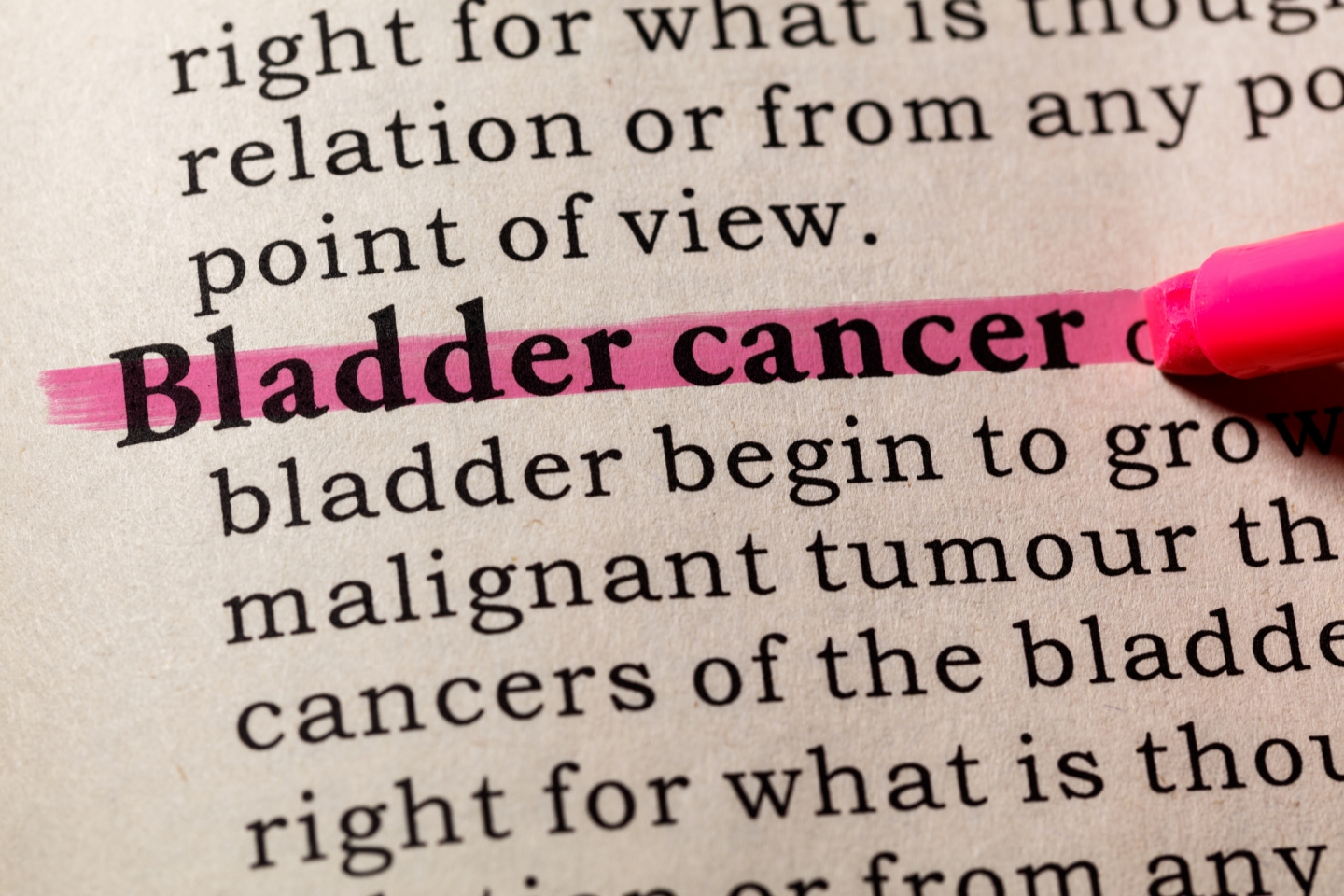 Highlighted text that reads "Bladder cancer"