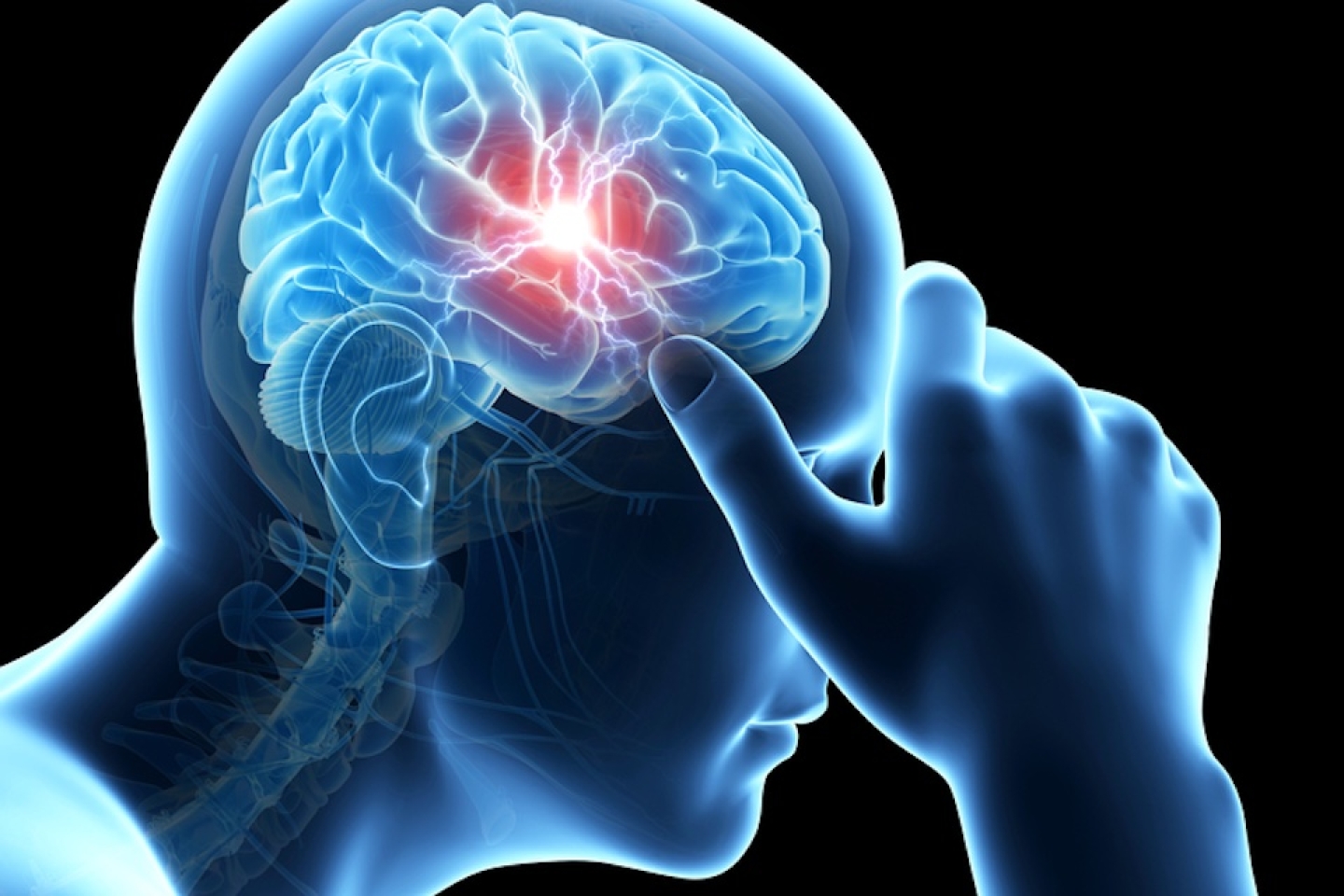 illustration of a man having a headache