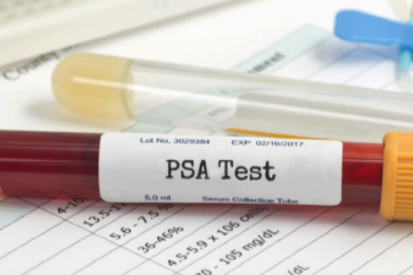 PSA Test tube