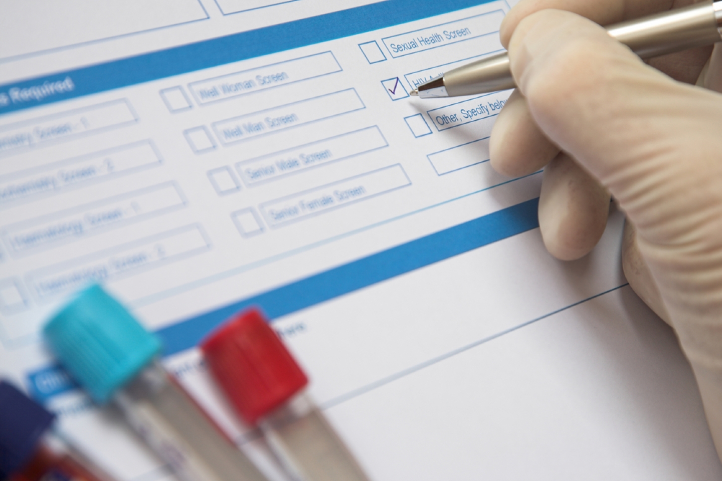 Doctor ticking box on a blood test form