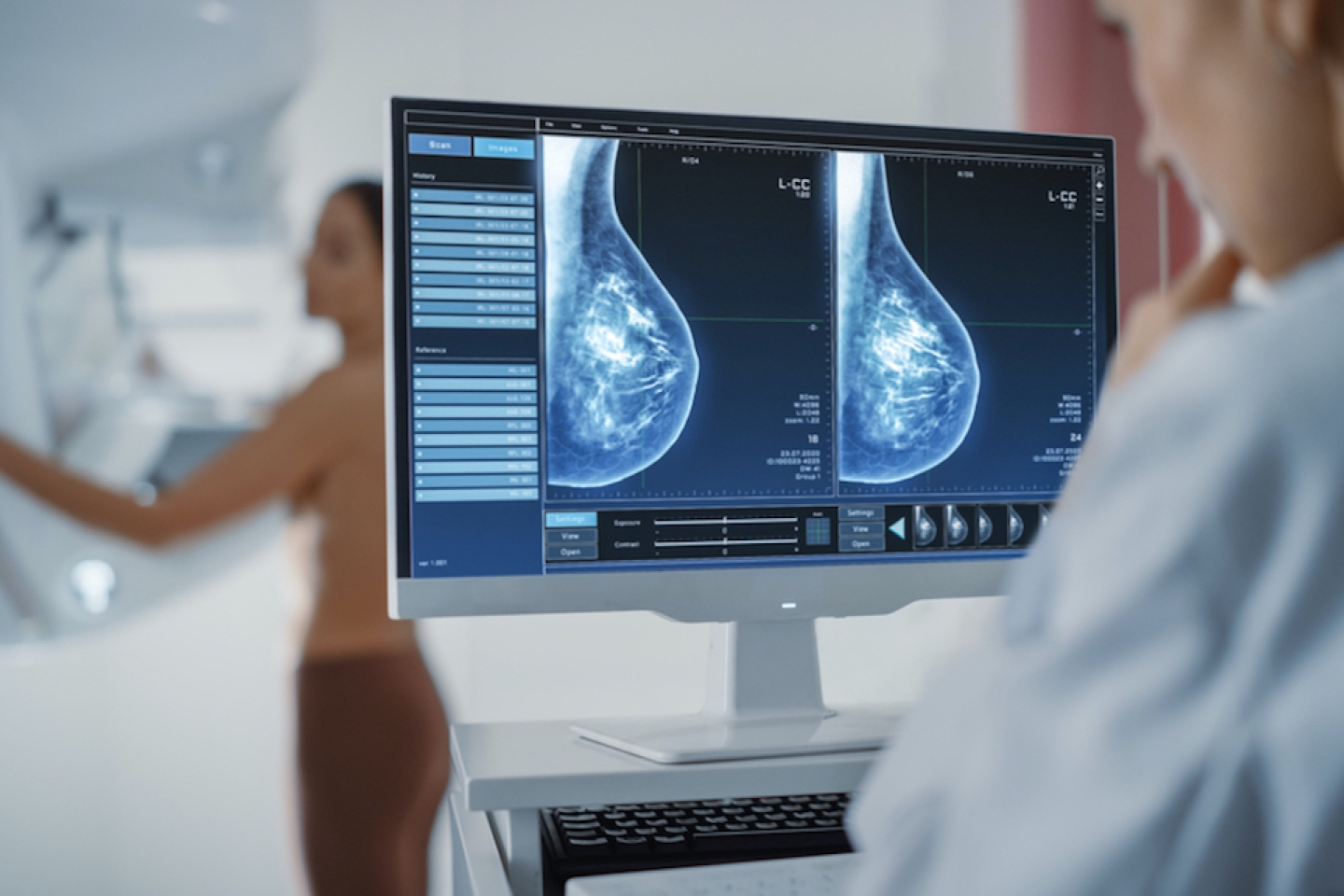 Woman Standing Topless Undergoing Mammography Screening Procedure. Screen Showing the Mammogram Scans of Dense Breast Tissues.