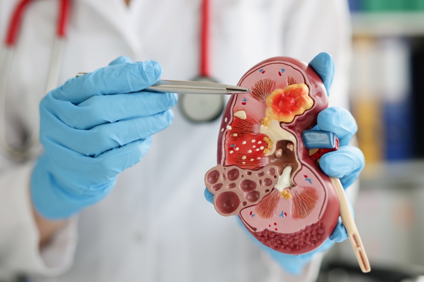 Urologist pointing pen kidney structure on anatomical model