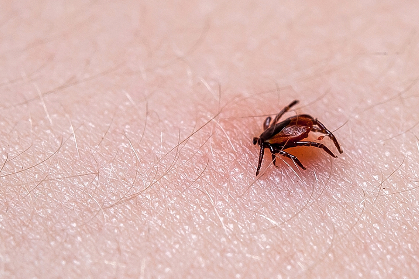 Tick Ixodes ricinus on human skin. tick wandering over human hand. Encephalitis tick.