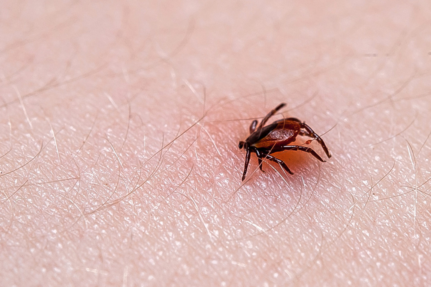 tick on skin