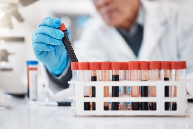 Blood, test tube and hands of scientist in laboratory with sample for research, medical study and science. Healthcare, pharmaceutical and old man with vial for dna testing, biology and rna analysis