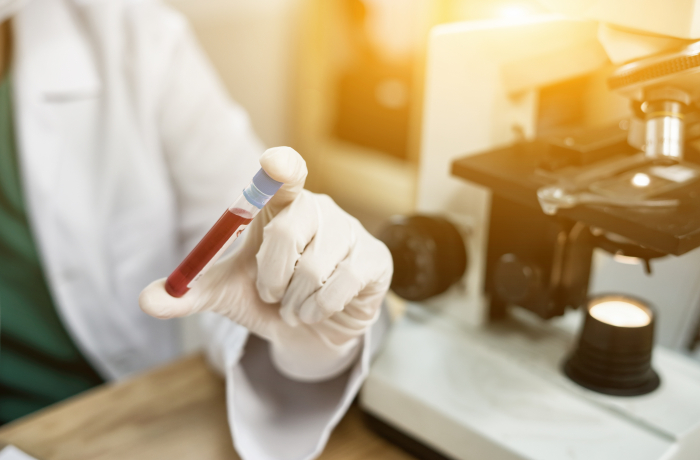blood test