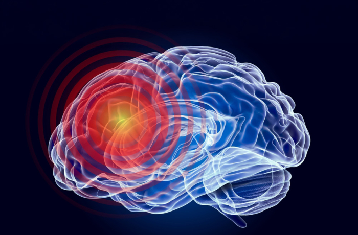 Brain picture graphics