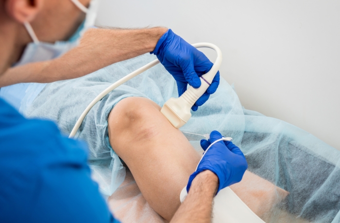 Cardiologist use tubes and ultrasound for radiofrequency catheter ablation.