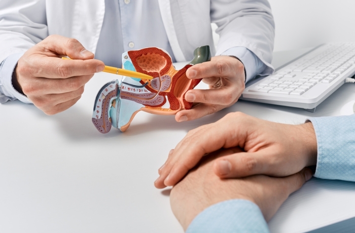 Prostate disease and treatment. Male reproductive system anatomical model in doctors hands close-up during consultation of male patient with suspected bacterial prostatitis