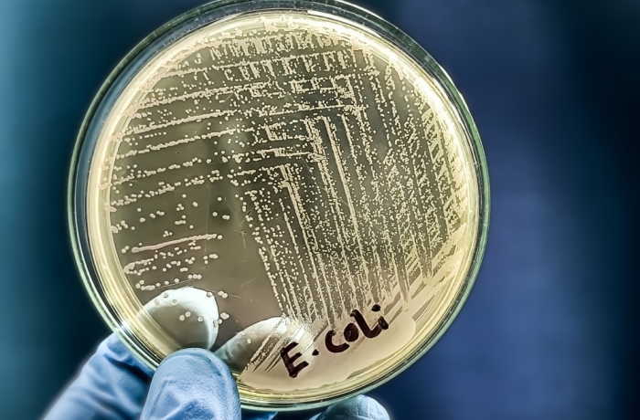 A microbiological culture Petri dish with a colonies of the pathogenic bacterium Escherichia coli (E. coli)