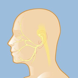 hemifacial spasm nerve