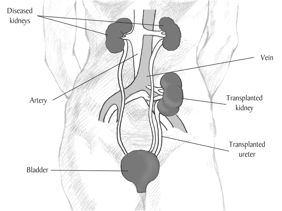 Diagram of the kidneys