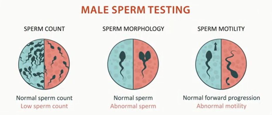 male sperm testing image
