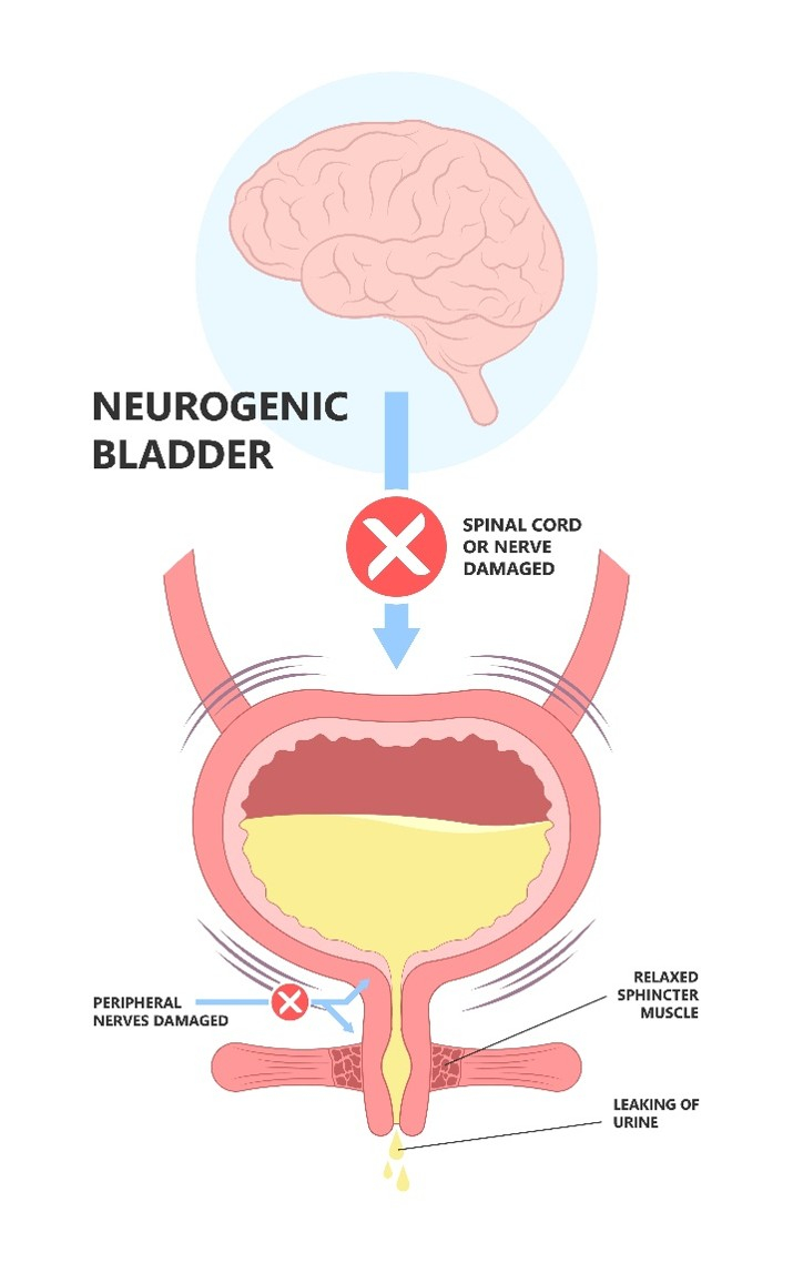 neurogenic_image