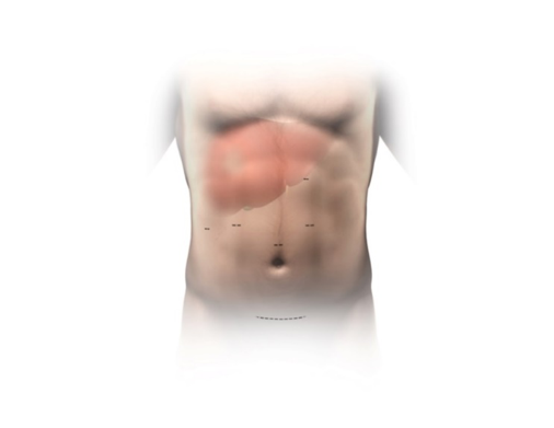 Illustration that shows where the liver is located in the abdomen