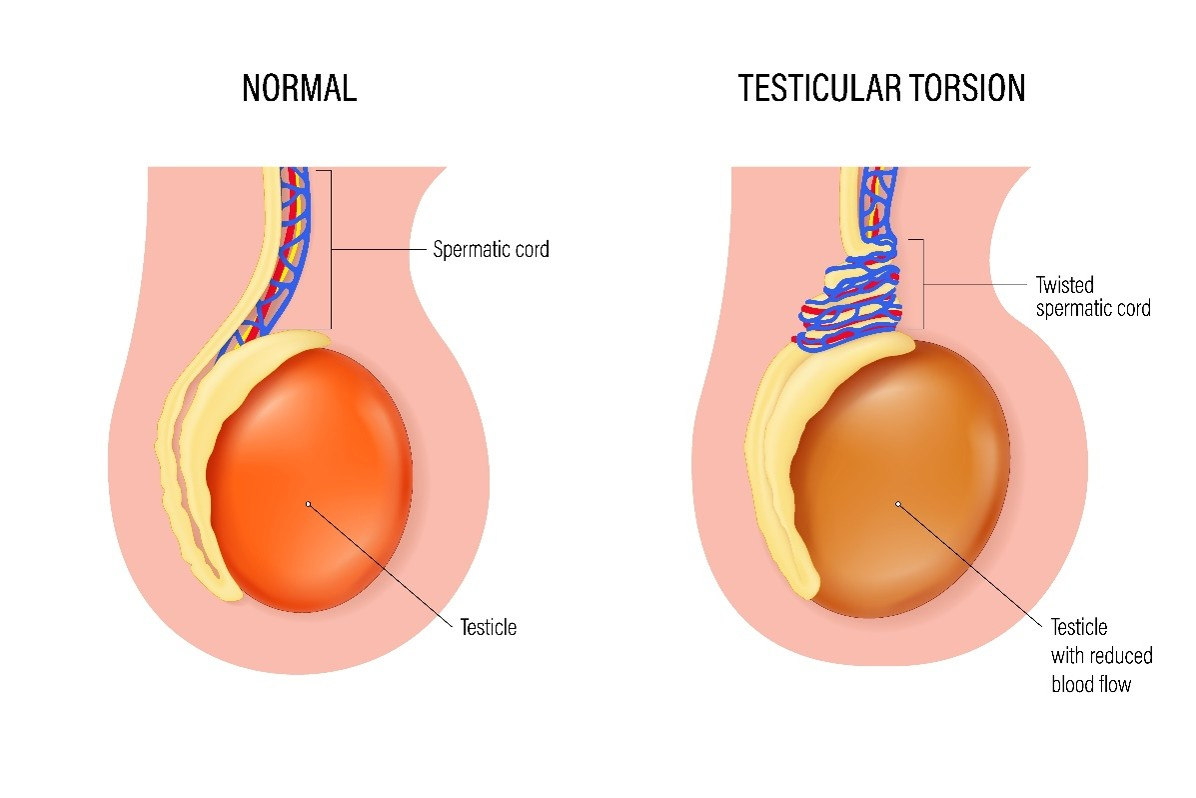 Testicle_image