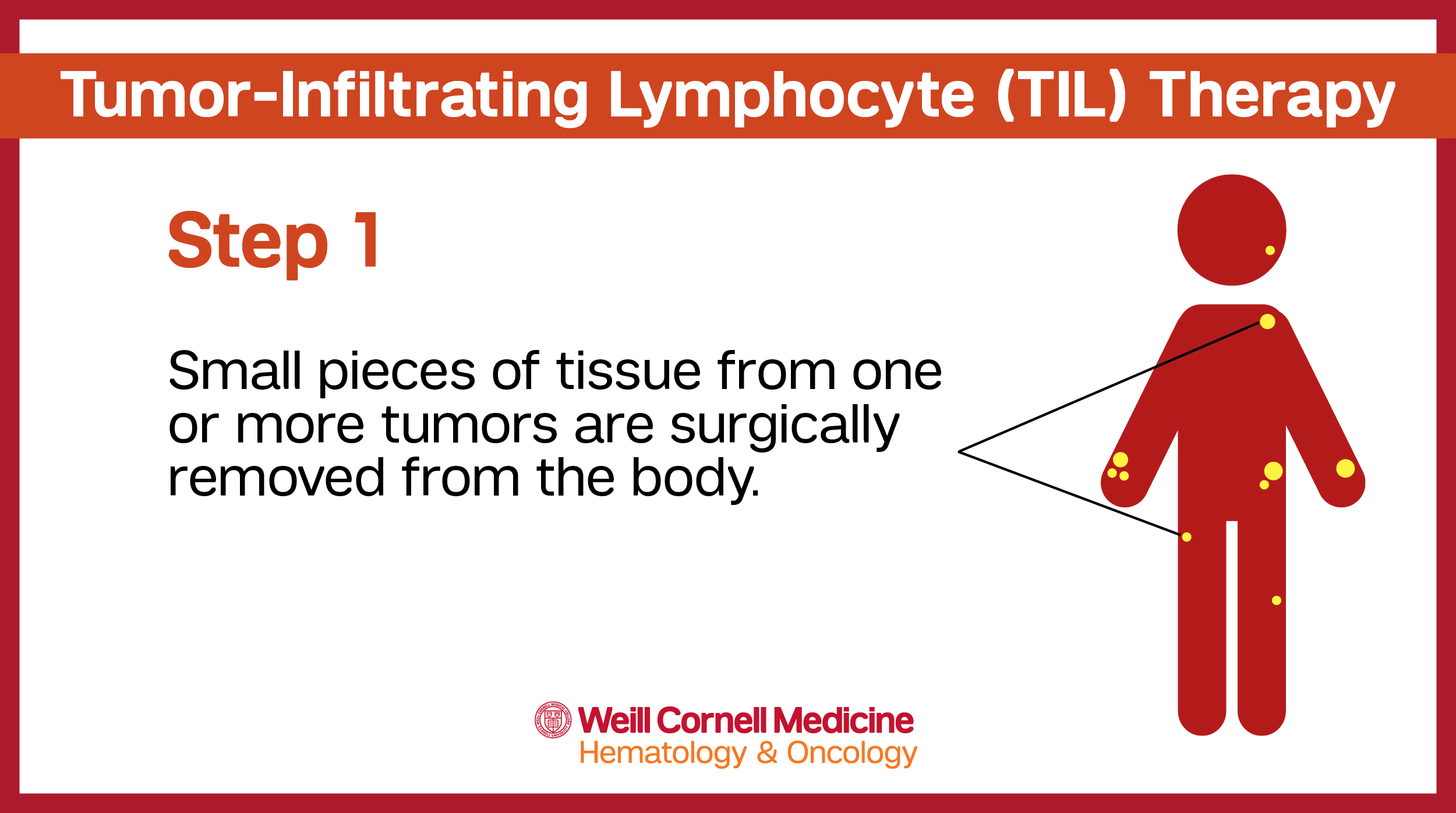 TIL Infographic Step 1