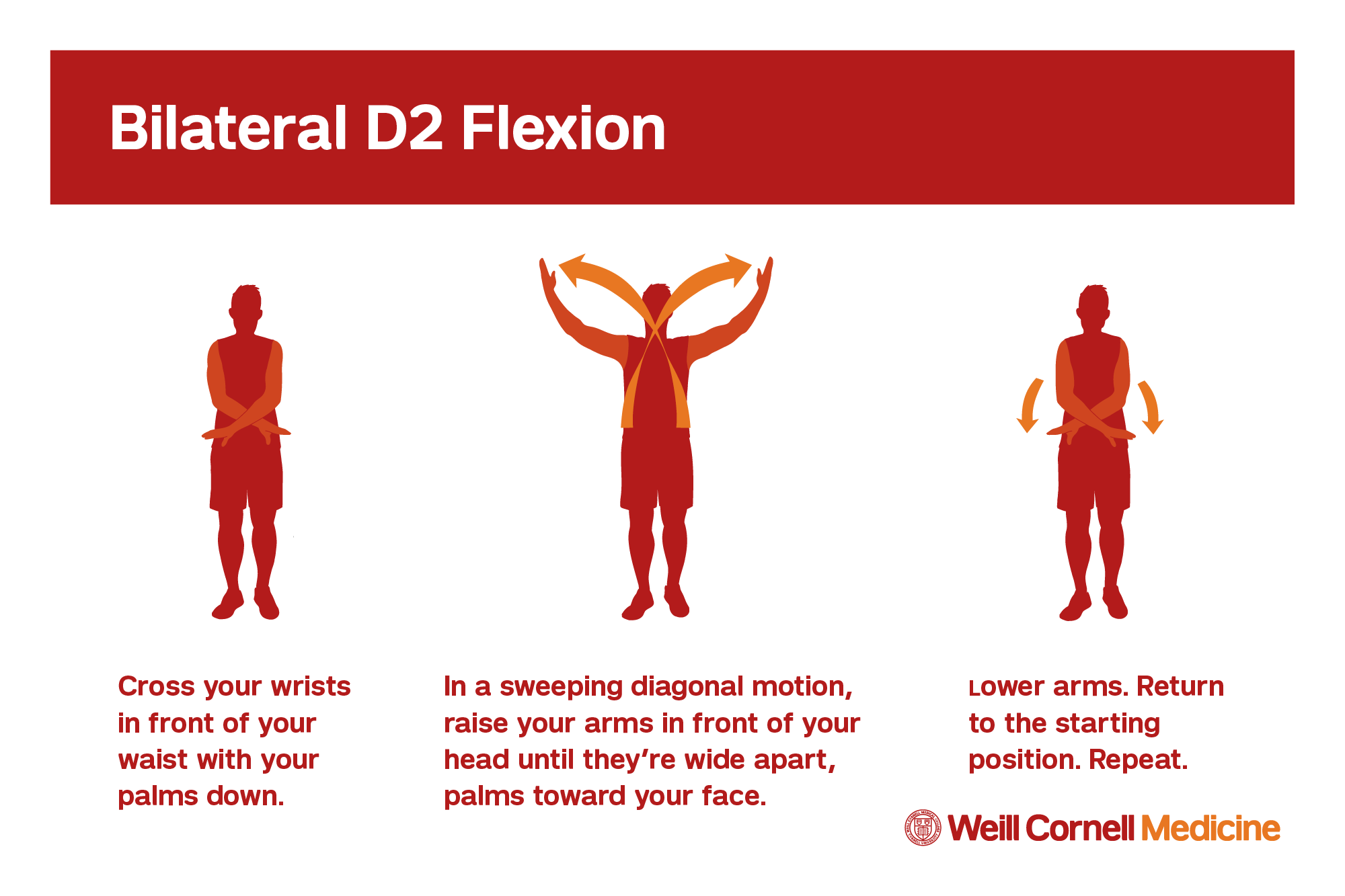 bilateral d2 flexion