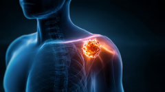 Tumor