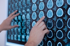 Closeup of physician reviewing brain scans.