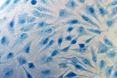 HeLa cervical cancer cells dyed blue