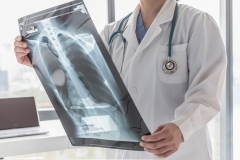 Doctor looking at a CT scan of a patient's lungs