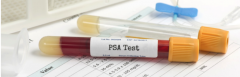 PSA Test tube