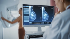Woman Standing Topless Undergoing Mammography Screening Procedure. Screen Showing the Mammogram Scans of Dense Breast Tissues.