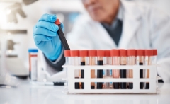 Blood, test tube and hands of scientist in laboratory with sample for research, medical study and science. Healthcare, pharmaceutical and old man with vial for dna testing, biology and rna analysis
