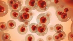 melanoma cells