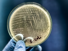 A microbiological culture Petri dish with a colonies of the pathogenic bacterium Escherichia coli (E. coli)