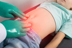 A surgeon doctor palpates the abdomen of the peri-umbilical zone during an abdominal hernia in a little girl. The concept of an extended umbilical ring, abdominal tension, umbilical hernia in children