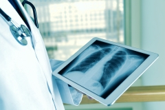 closeup of a young doctor man observing a chest radiograph in a tablet computer